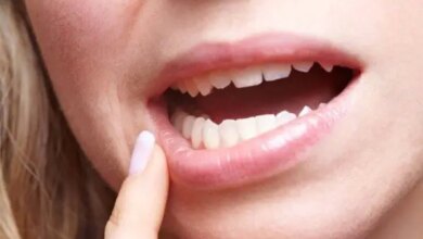 تعبیر خواب افتادن دندان بدون خون برای زنان مجرد و متاهل و مردان