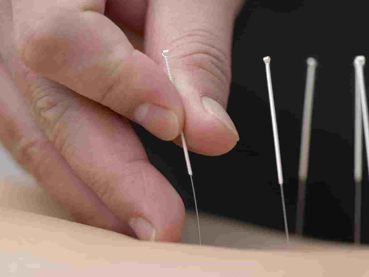 تعبیر خواب سوزن یا سنجاق چیست؟